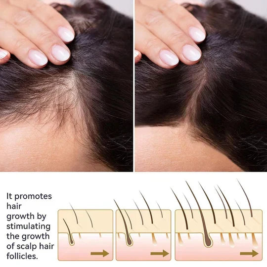 FEG Hair Growth Spray